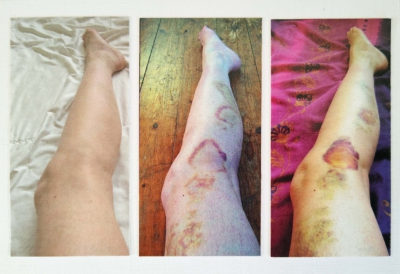 About the Legs (25 04 04, #32) About the Legs (25 04 04, #32)